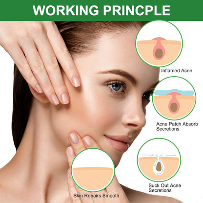 Colloidal Invisible Acne Patch – Hydrocolloid Pimple Patch for Fast Blemish Healing | Ultra-Thin, Day & Night Wear, 3 Sizes