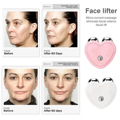 Before and after photos showing facial lifting and improved jawline after 60 days using heart-shaped face lifter devices